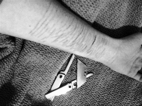 braço cortado depresao - foto de tatuagem no braço